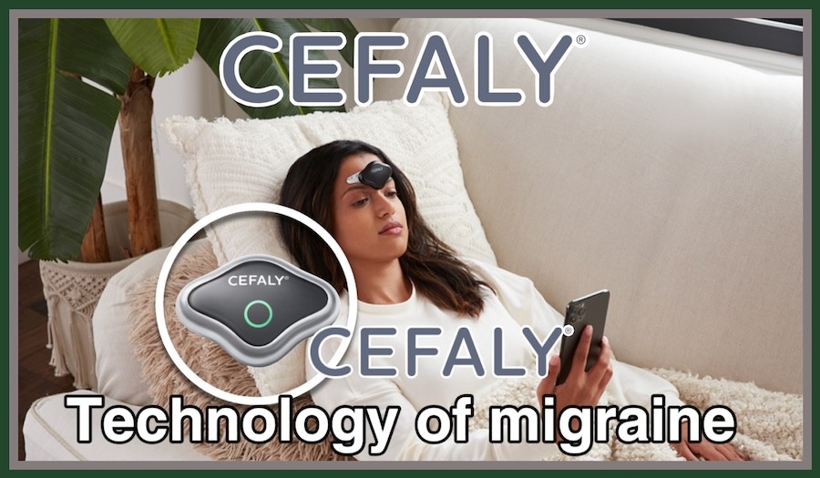 CEFALY Review: Innovative Migraine Relief Technology